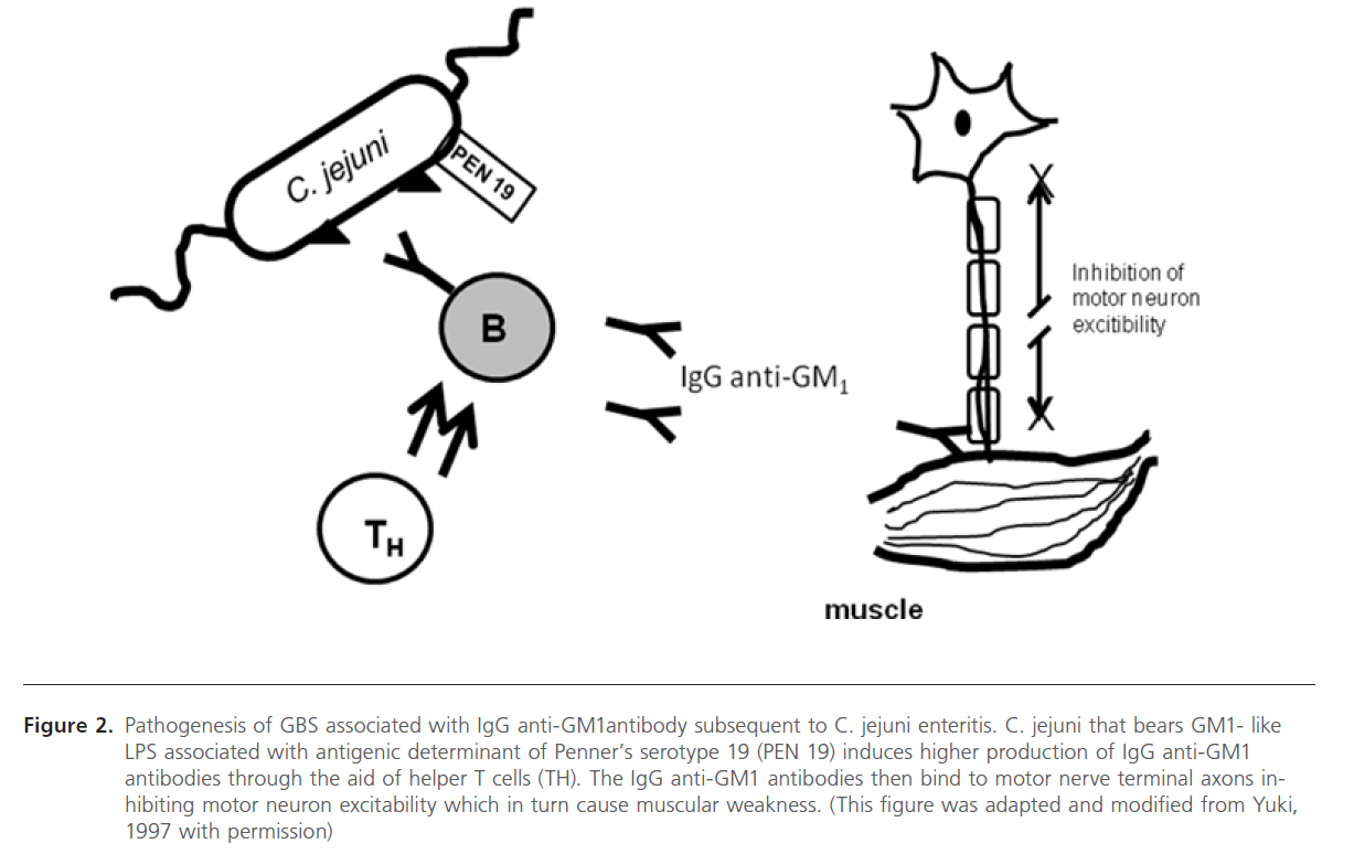 Campylobacter Jejuni Mediated Guillain Barre Syndrome An Overview Of The Molecular Mimicry And Vaccine Development Approaches Insight Medical Publishing