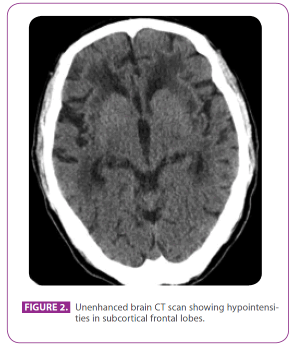 jnuero-Unenhanced-brain-